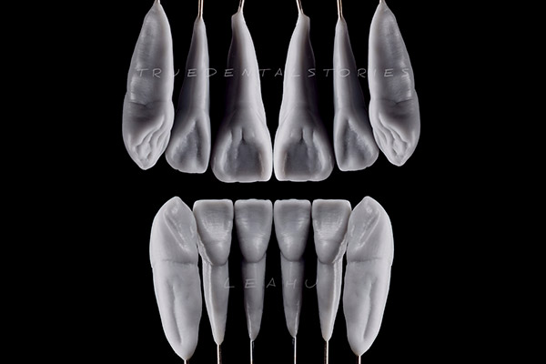 cas-leahu-3