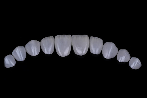cas-ouar-3