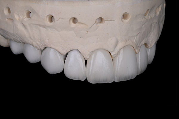 cas-ouar-5